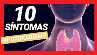 10 SIGNOS Y SÍNTOMAS DE HIPOTIROIDISMO  GLÁNDULA TIROIDES [upl. by Berners752]