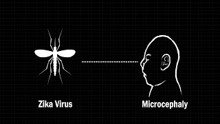 How the Zika virus affects an infants brain [upl. by Rice]