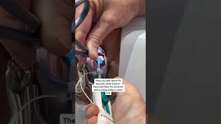 This is how an IUD is inserted [upl. by Wiebmer206]