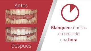 Conozca el blanqueamiento dental en consultorio Opalescence Boost [upl. by Thora]