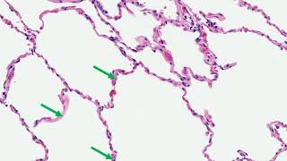 Histology of the lung explained by a pulmonary pathologist part 1 [upl. by Danae554]