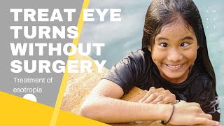 Treatment for eye turns without surgery  Vision Therapy for Esotropia [upl. by Sardse]