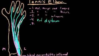 Tennis Elbow Treatment Prevention amp Rehabilitation Exercises Explained [upl. by Aillij]