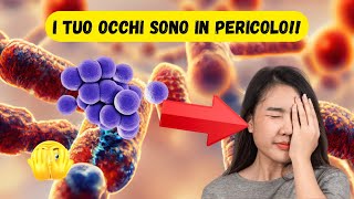 ATTENZIONE‼️ il tuo OCCHIO può essere in PERICOLO🤕 [upl. by Ddot]