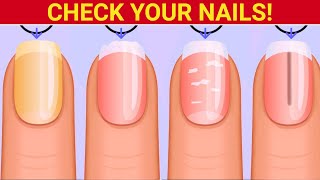 9 Things Your Nails Can Tell You About Your Health [upl. by Fidelis]