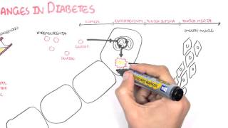 Diabetes Complication and Pathophysiology of the complication [upl. by Ahsimek908]