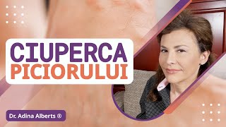 Ciuperca Piciorului  Ciuperca Unghiei  Sfaturi și recomandări simple  Prevenție și Tratament [upl. by Mundford813]