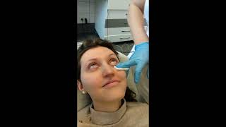 JETT PLASMA LIFT MEDICAL  Dr Jestřábová performs treatment of Dry Eye [upl. by Ilojna101]