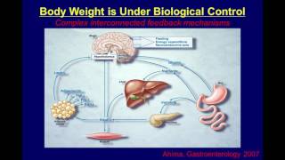 David Ludwig MD PhD  Which Comes First Overeating or Obesity [upl. by Cinderella892]