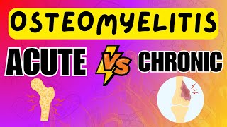 Osteomyelitis  Acute vs Chronic Osteomyelitis  Explained in 5 Minutes [upl. by Brom127]