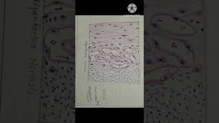 shortsshortsvideo youtubeshorts pathology cell death necrosis apoptosis 2nd year mbbs [upl. by Nashom]