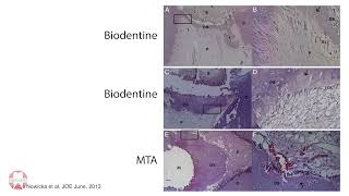 Bioactivity of tricalcium silicate  Prof Imad About [upl. by Ysteb]