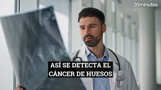 CÁNCER DE HUESOS  Síntomas y prevención [upl. by Trevar]