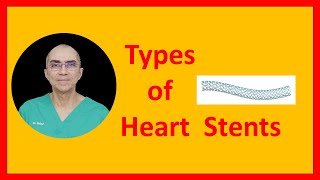 Types of Stents [upl. by Kerrin587]