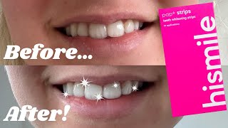 HiSmile Teeth Whitening Strips  Better than Oral B 3D whitestrips [upl. by Oirotciv]