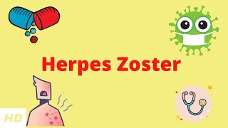 Herpes Zoster Causes Signs and Symptoms Diagnosis and Treatment [upl. by Nnairam]