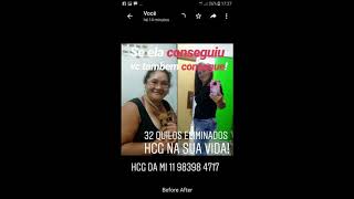 Dieta HCGOVIDAC 10000uis e HUCOG 10000uis Maravilhosos 11 983984717 HCG injetável O melhor [upl. by Saraann]