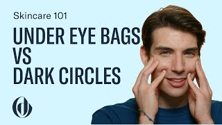 Difference Between Under Eye Bags and Dark Circles and How to Treat Them [upl. by Hook]