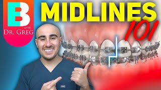 Braces Midlines 101  Elastics IPR Coils and more [upl. by Retsof]