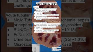 Acute kidney injury [upl. by Ulane]