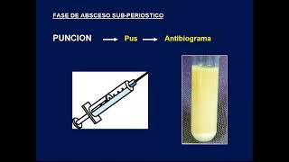 Traumatologia  6 Infecciones osteoarticulares [upl. by Liamaj]