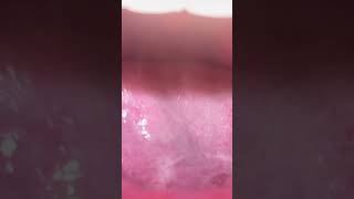 Humid Embrace￼ mouthsounds mouth tongue uvula [upl. by Ilesara]