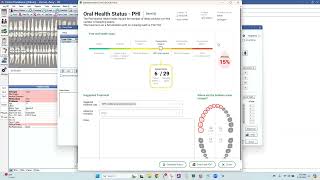 Voice Enabled Perio Charting amp PHI Reporting for Open Dental with Denti AI Voice [upl. by Anabel]