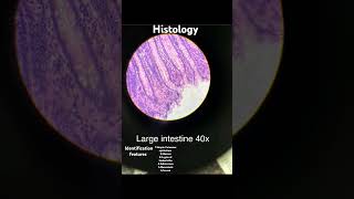 ANATOMY  HISTOLOGY  LARGE INTESTINES  IDENTIFICATION FEATURES mbbs anatomy life histology [upl. by Aranaj]