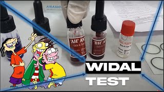 WIDAL TEST  SLIDE AGGLUTINATION TEST  TYPHOID FEVER  MICROBIOLOGY  MBBS  REVISION [upl. by Rice]