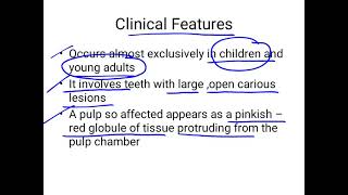 chronic hyperplastic pulpitis [upl. by Yonita]