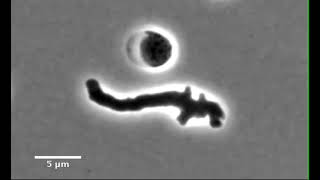 Cholera bacteria reawakening after antibiotic exposure [upl. by Drusy]