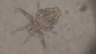 Nauplius Larva of Cyclops crustacean [upl. by Iah]