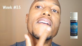 Minoxidil Beard Journey Applying the product Week 35 [upl. by Jarred]