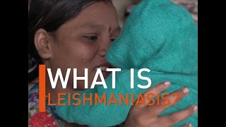 What is Leishmaniasis [upl. by Henleigh]