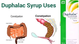 duphalac dry uses  duphalac syrup uses  duphalac  uses in urdu Hindi [upl. by Meehahs]