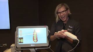 Scanning for a SingleUnit Crown with the iTero Element® 2 Intraoral Scanner [upl. by Affer]