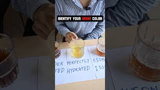 Identify your URINE colour 😱 youtubeshort neetmcq motivation ytshorts trending neet viral [upl. by Nilak]