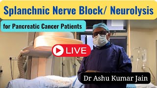 Splanchnic Nerve Block Neurolysis  Innovative Pain Relief for Pancreatic Cancer Patients [upl. by Anawek]