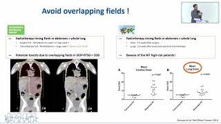 quotAdvances in Radiotherapy of Wilms Tumorquot [upl. by Oirram]