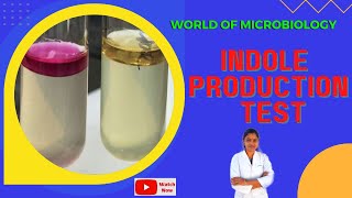 Indole Production Test Tamil Biochemical Test  IMViC Test  Identification of Bacteria [upl. by Philemol]