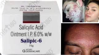 Salipic 6 Ointment Cream Salicylic Acid Ointment IP 60 ww [upl. by Florida457]