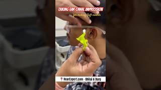 Taking ear canal impression for making BTE soft moulds hearingaids bhilai durg rajnandgaon [upl. by Bevin]