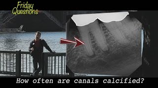 How often are canals calcified Friday Questions [upl. by Duffie]