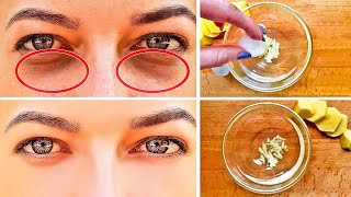 How to Get Rid of Black Circles Under Your Eyes [upl. by Huskey]