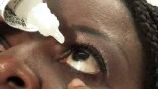 LASIK Recovery How to Use Eye Drops Shorts [upl. by Teressa218]