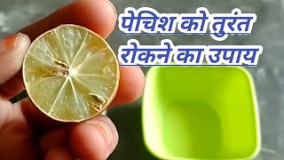 दस्त पेचिश या पेट की गर्मी को खत्म करने का घरेलू उपाय Pechis ka ilaj [upl. by Airemat]