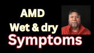 😎 Macular Degeneration Symptoms AMD Wetb amp Dry [upl. by Mano]