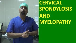 What is Cervical spondylosis Cervical Spinal cord compression and Myelopathy मानेचा संधिवात [upl. by Melc]