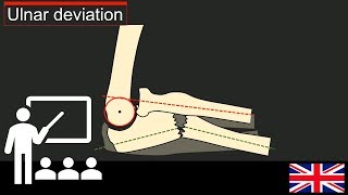 Lectures Understanding Monteggia Lesions [upl. by Laicram840]