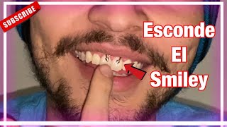 🟢 Como esconder el piercing SMILEY  como esconder un piercing Perforaciones 2021 Burbuja Psicopata [upl. by Recnal267]